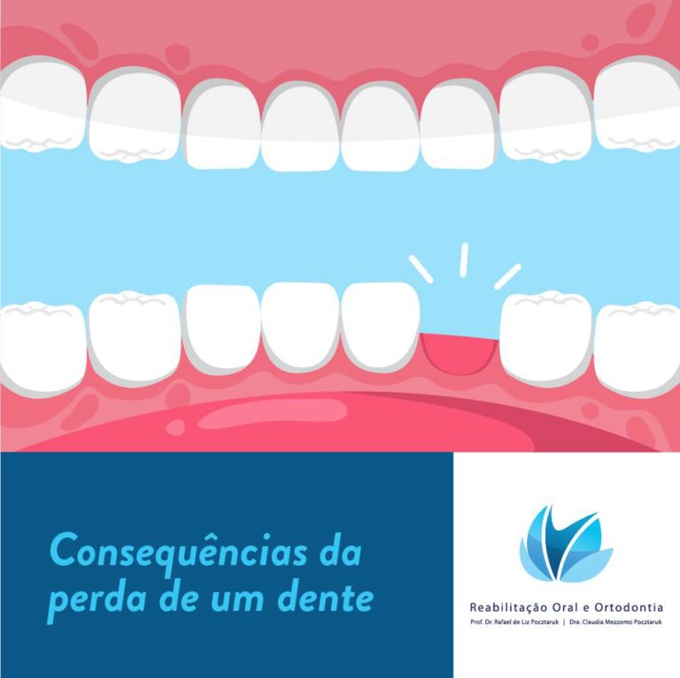 Dr. Rafael Pocztaruk perda de um dente